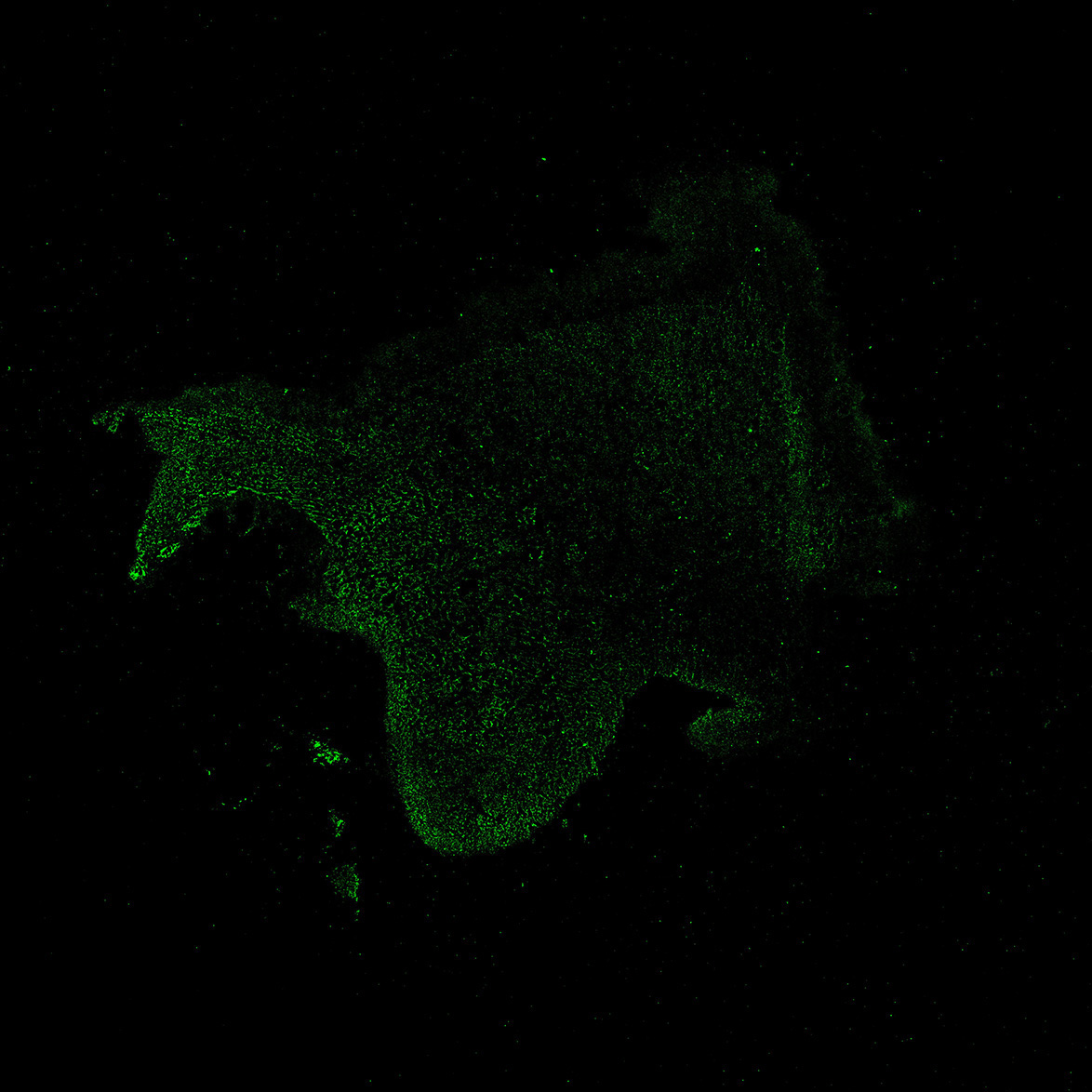 Human foetal midbrain